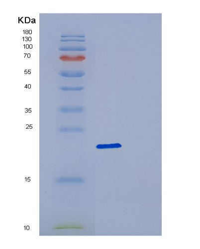 SDS-PAGE analysis of Human DCTD (Deoxycytidylate Deaminase) - Recombinant Protein, showing >90% purity under 15% SDS-PAGE (Reduced)