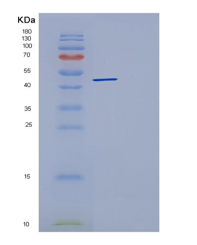 SDS-PAGE analysis of Human DCTN2 (Dynactin Subunit 2) - Recombinant Protein, showing >90% purity under 15% SDS-PAGE (Reduced)