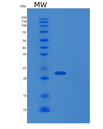 SDS-PAGE analysis of Human DCTN6 (Dynactin Subunit 6) - Recombinant Protein, showing >90% purity under 15% SDS-PAGE (Reduced)
