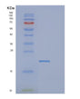 SDS-PAGE analysis of Human DCTPP1 (Dctp Pyrophosphatase 1) - Recombinant Protein, showing >95% purity under 15% SDS-PAGE (Reduced)