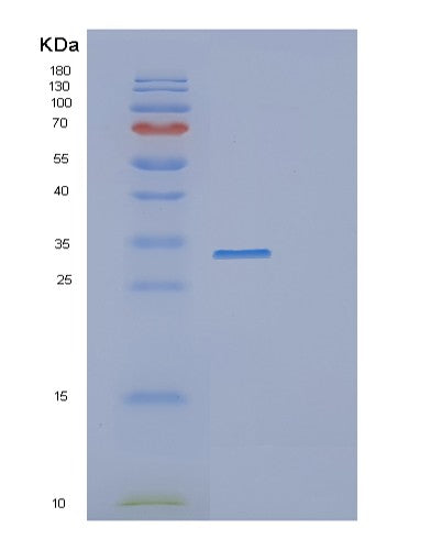 SDS-PAGE analysis of Human DDX39A (Atp-Dependent Rna Helicase Ddx39A) - Recombinant Protein, showing >95% purity under 15% SDS-PAGE (Reduced)