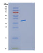 SDS-PAGE analysis of Mouse Dcn (Decorin) - Recombinant Protein, showing >85% purity under 15% SDS-PAGE (Reduced)