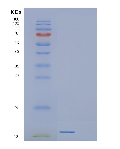 SDS-PAGE analysis of Human DEFB116 (Beta-Defensin 116) - Recombinant Protein, showing >85% purity under 15% SDS-PAGE (Reduced)