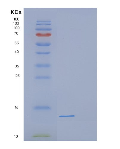 SDS-PAGE analysis of Human DEFB118 (Defensin Beta 118) - Recombinant Protein, showing >95% purity under 15% SDS-PAGE (Reduced)