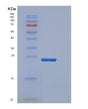 SDS-PAGE analysis of Human DENR (Density-Regulated Protein) - Recombinant Protein, showing >85% purity under 15% SDS-PAGE (Reduced)