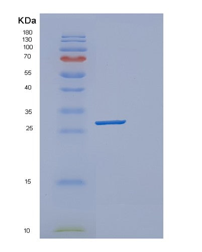 SDS-PAGE analysis of Human deoC - Recombinant Protein, CAT# BLT-08373P showing >90% purity under 15% SDS-PAGE (Reduced)