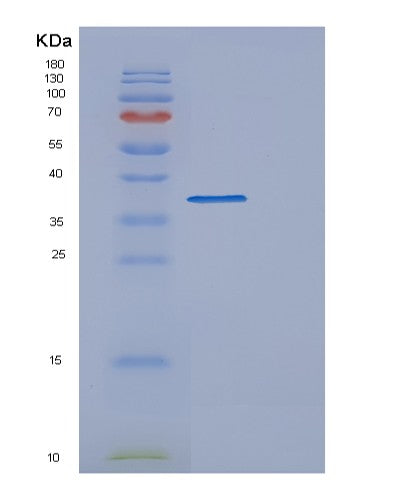 SDS-PAGE analysis of Human DFFA (Dna Fragmentation Factor Subunit Alpha) - Recombinant Protein, showing >90% purity under 15% SDS-PAGE (Reduced)