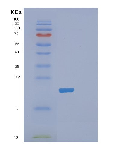 SDS-PAGE analysis of Human DHFR (Dihydrofolate Reductase) - Recombinant Protein, showing >90% purity under 15% SDS-PAGE (Reduced)
