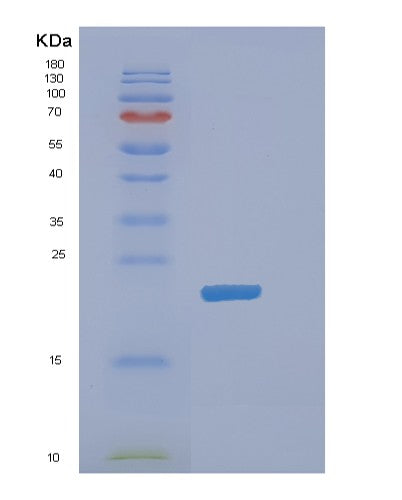 SDS-PAGE analysis of Mouse Dhfr (Dihydrofolate Reductase) - Recombinant Protein, showing >85% purity under 15% SDS-PAGE (Reduced)