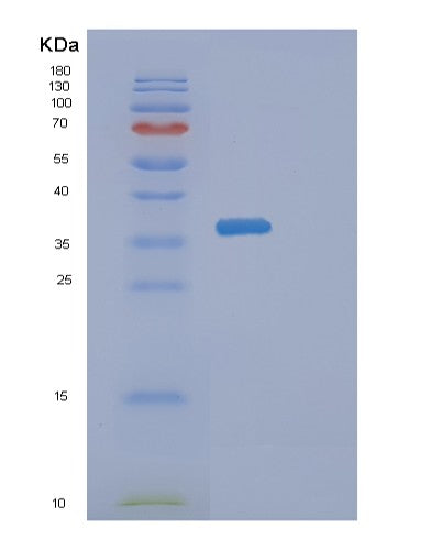 SDS-PAGE analysis of Human DIMT1 (Dimethyladenosine Transferase) - Recombinant Protein, showing >90% purity under 15% SDS-PAGE (Reduced)