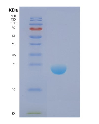 SDS-PAGE analysis of Human DIRAS1 (Gtp-Binding Protein Di-Ras1) - Recombinant Protein, showing >85% purity under 15% SDS-PAGE (Reduced)
