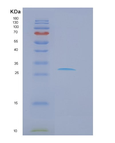 SDS-PAGE analysis of Human DKK1 (Dickkopf-Related Protein 1) - Recombinant Protein, showing >90% purity under 15% SDS-PAGE (Reduced)