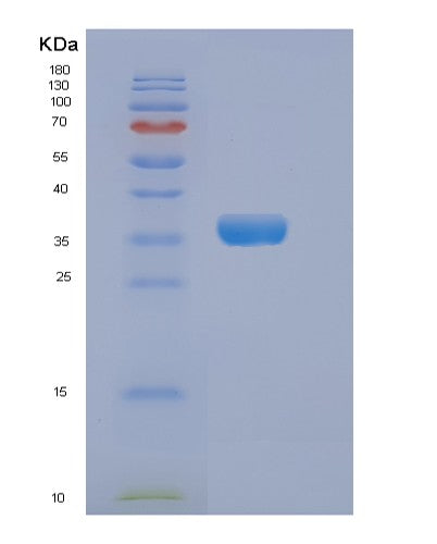 SDS-PAGE analysis of Human DKK3 (Dickkopf-Related Protein 3) - Recombinant Protein, showing >90% purity under 15% SDS-PAGE (Reduced)