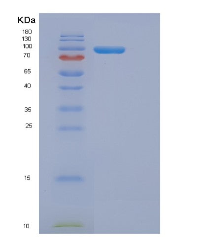 SDS-PAGE analysis of Human DMGO (Dimethylglycine oxidase) Arthrobacter globiformis - Recombinant Protein, showing >90% purity under 15% SDS-PAGE (Reduced)