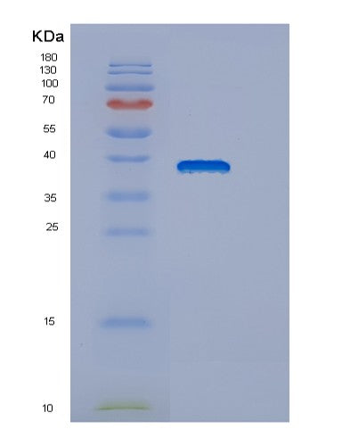 SDS-PAGE analysis of Human DNAJB6 (Dnaj Homolog Subfamily B Member 6) - Recombinant Protein, showing >95% purity under 15% SDS-PAGE (Reduced)