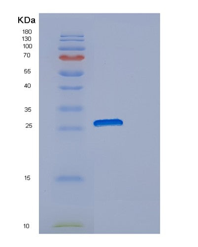 SDS-PAGE analysis of Human DNAJB8 (Dnaj Homolog Subfamily B Member 8) - Recombinant Protein, showing >90% purity under 15% SDS-PAGE (Reduced)