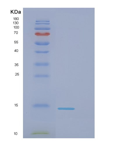 SDS-PAGE analysis of Human DNAL4 (Dynein Axonemal Light Chain 4) - Recombinant Protein, showing >95% purity under 15% SDS-PAGE (Reduced)