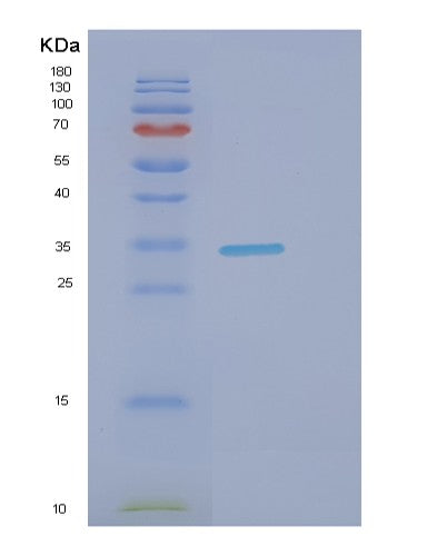 SDS-PAGE analysis of Human DNALI1 (Axonemal Dynein Light Intermediate Polypeptide 1) - Recombinant Protein, showing >90% purity under 15% SDS-PAGE (Reduced)