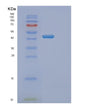 SDS-PAGE analysis of Human DNMT3L (Dna (Cytosine-5)-Methyltransferase 3-Like) - Recombinant Protein, showing >95% purity under 15% SDS-PAGE (Reduced)