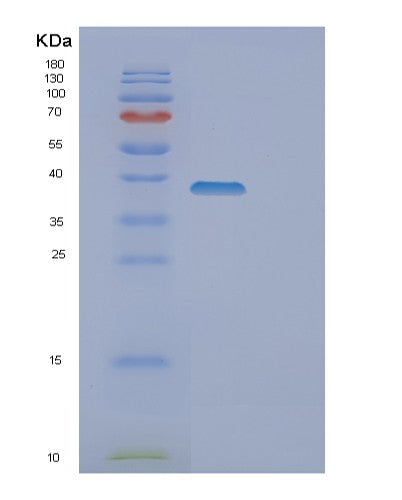 SDS-PAGE analysis of Human DOK4 (Docking Protein 4) - Recombinant Protein, showing >85% purity under 15% SDS-PAGE (Reduced)