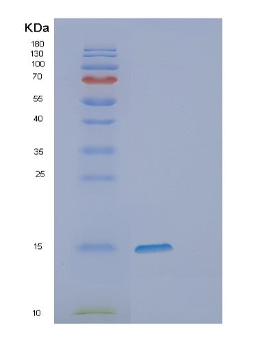 SDS-PAGE analysis of Human DPPA5 (Developmental Pluripotency-Associated 5 Protein) - Recombinant Protein, showing >85% purity under 15% SDS-PAGE (Reduced)