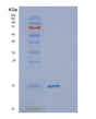 SDS-PAGE analysis of Human DPPA5 (Developmental Pluripotency-Associated 5 Protein) - Recombinant Protein, showing >85% purity under 15% SDS-PAGE (Reduced)