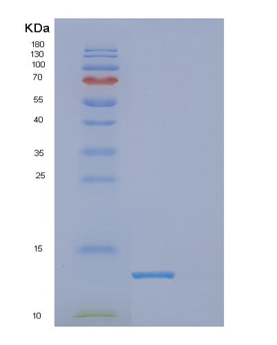 SDS-PAGE analysis of Human DPY30 (Protein Dpy-30 Homolog) - Recombinant Protein, showing >95% purity under 15% SDS-PAGE (Reduced)