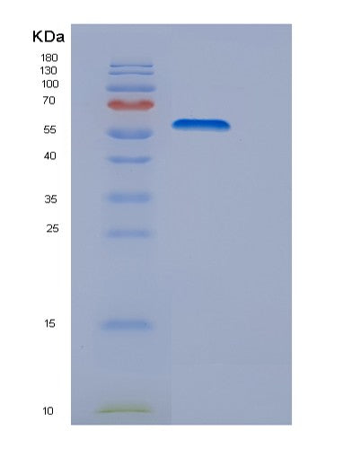 SDS-PAGE analysis of Human DRS (Aspartyl-tRNA synthetase) - Recombinant Protein, showing >95% purity under 15% SDS-PAGE (Reduced)