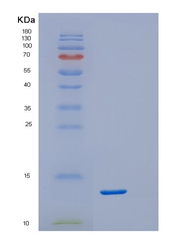 SDS-PAGE analysis of Human RCAN1 (Calcipressin-1) - Recombinant Protein, showing >95% purity under 15% SDS-PAGE (Reduced)
