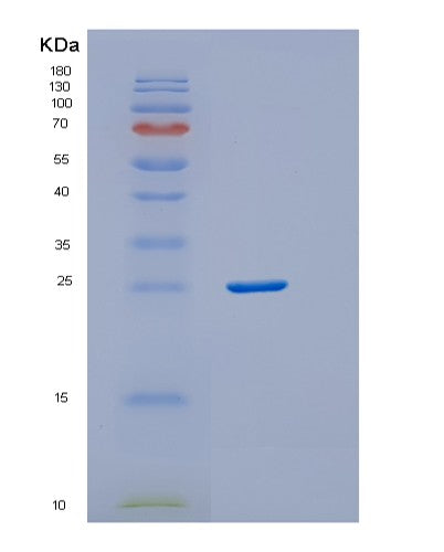 SDS-PAGE analysis of Human DTD1 (D-Aminoacyl-Trna Deacylase 1) - Recombinant Protein, showing >85% purity under 15% SDS-PAGE (Reduced)