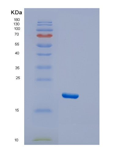 SDS-PAGE analysis of Human DTD2 (D-Aminoacyl-Trna Deacylase 2) - Recombinant Protein, showing >95% purity under 15% SDS-PAGE (Reduced)
