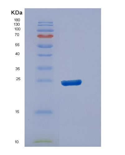 SDS-PAGE analysis of Human DUSP13A (Dual Specificity Protein Phosphatase 13A) - Recombinant Protein, showing >95% purity under 15% SDS-PAGE (Reduced)