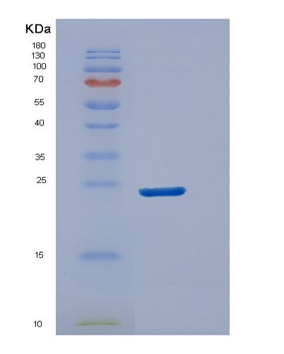 SDS-PAGE analysis of Human DUSP18 (Dual Specificity Protein Phosphatase 18) - Recombinant Protein, showing >90% purity under 15% SDS-PAGE (Reduced)