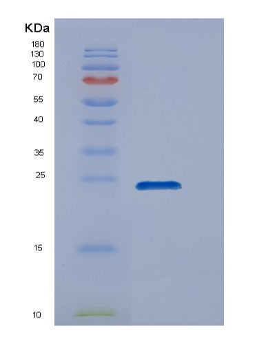 SDS-PAGE analysis of Human DUSP18 (Dual Specificity Protein Phosphatase 18) - Recombinant Protein, showing >85% purity under 15% SDS-PAGE (Reduced)
