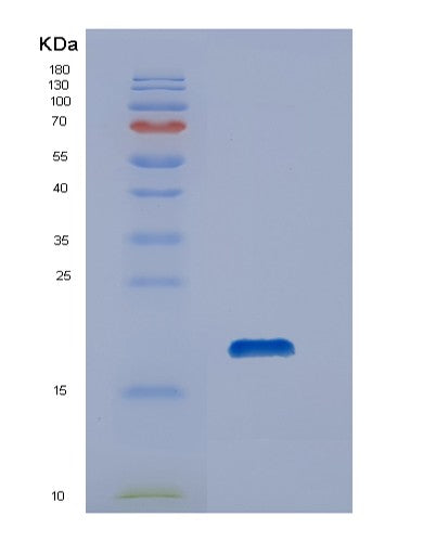SDS-PAGE analysis of Human DUSP19 (Dual Specificity Protein Phosphatase 19) - Recombinant Protein, showing >95% purity under 15% SDS-PAGE (Reduced)