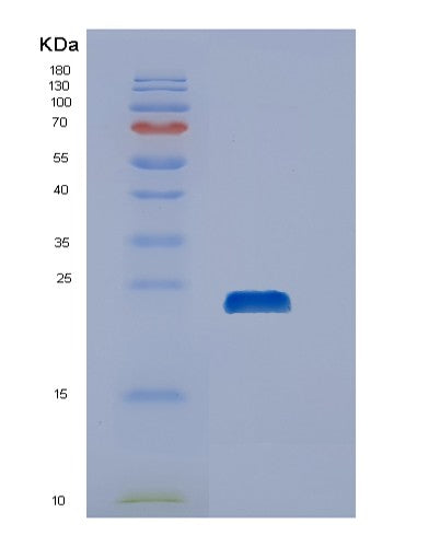 SDS-PAGE analysis of Human DUSP21 (Dual Specificity Protein Phosphatase 21) - Recombinant Protein, showing >90% purity under 15% SDS-PAGE (Reduced)
