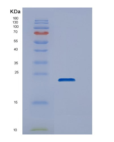 SDS-PAGE analysis of Human DUSP22 (Dual Specificity Protein Phosphatase 22) - Recombinant Protein, showing >85% purity under 15% SDS-PAGE (Reduced)