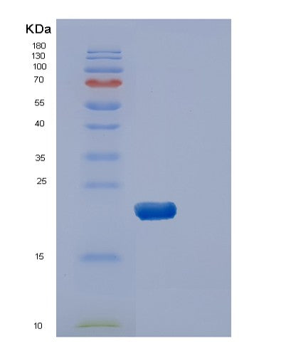 SDS-PAGE analysis of Human DUSP3 (Dual Specificity Protein Phosphatase 3) - Recombinant Protein, showing >95% purity under 15% SDS-PAGE (Reduced)