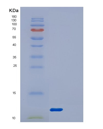SDS-PAGE analysis of Human DYNLRB1 (Dynein Light Chain Roadblock-Type 1) - Recombinant Protein, showing >85% purity under 15% SDS-PAGE (Reduced)