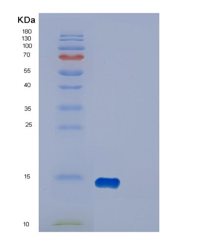 SDS-PAGE analysis of Human DYNLT1 (Dynein Light Chain Tctex-Type 1) - Recombinant Protein, showing >90% purity under 15% SDS-PAGE (Reduced)