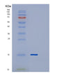 SDS-PAGE analysis of Human DYNLT3 (Dynein Light Chain Tctex-Type 3) - Recombinant Protein, showing >85% purity under 15% SDS-PAGE (Reduced)