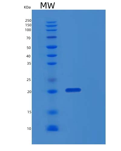 SDS-PAGE analysis of Human EBAG9 (Receptor-Binding Cancer Antigen Expressed On Siso Cells) - Recombinant Protein, showing >95% purity under 15% SDS-PAGE (Reduced)