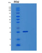 SDS-PAGE analysis of Human EBAG9 (Receptor-Binding Cancer Antigen Expressed On Siso Cells) - Recombinant Protein, showing >95% purity under 15% SDS-PAGE (Reduced)