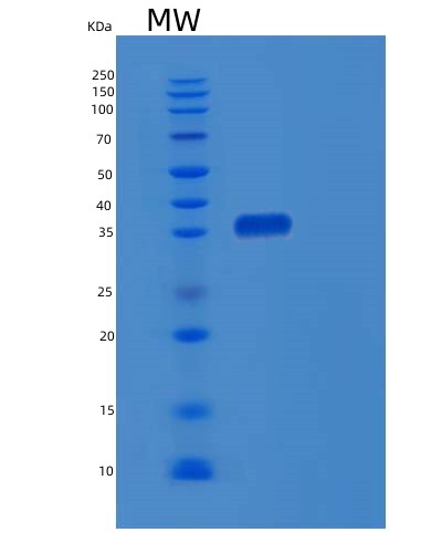 SDS-PAGE analysis of Human EBNA1BP2 (Probable Rrna-Processing Protein Ebp2) - Recombinant Protein, showing >90% purity under 15% SDS-PAGE (Reduced)