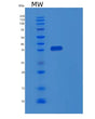 SDS-PAGE analysis of Human EBNA1BP2 (Probable Rrna-Processing Protein Ebp2) - Recombinant Protein, showing >90% purity under 15% SDS-PAGE (Reduced)