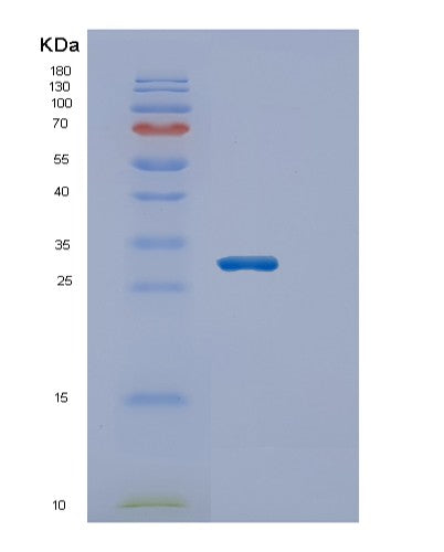 SDS-PAGE analysis of Human ECHS1 (Enoyl-Coa Hydratase, Mitochondrial) - Recombinant Protein, showing >90% purity under 15% SDS-PAGE (Reduced)