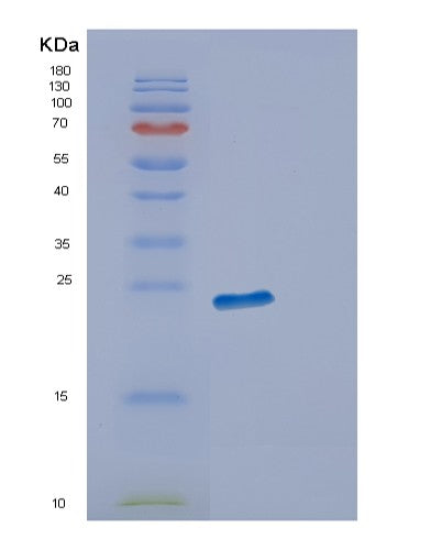 SDS-PAGE analysis of Human ECSIT (Evolutionarily Conserved Signaling Intermediate In Toll Pathway, Mitochondrial) - Recombinant Protein, showing >85% purity under 15% SDS-PAGE (Reduced)