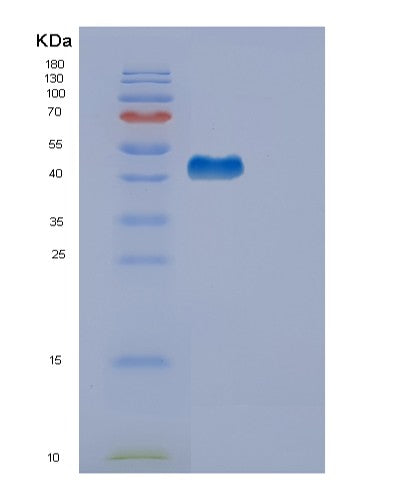 SDS-PAGE analysis of Human EDA2R (Tumor Necrosis Factor Receptor Superfamily Member 27) - Recombinant Protein, showing >90% purity under 15% SDS-PAGE (Reduced)