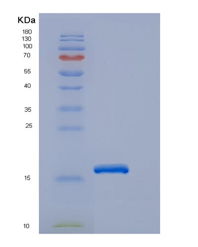 SDS-PAGE analysis of Human EDA2R (Tumor Necrosis Factor Receptor Superfamily Member 27) - Recombinant Protein, showing >90% purity under 15% SDS-PAGE (Reduced)