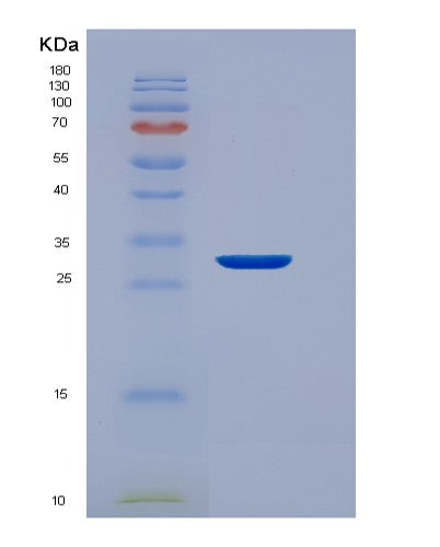 SDS-PAGE analysis of Human EEF1D (Elongation Factor 1-Delta) - Recombinant Protein, showing >95% purity under 15% SDS-PAGE (Reduced)